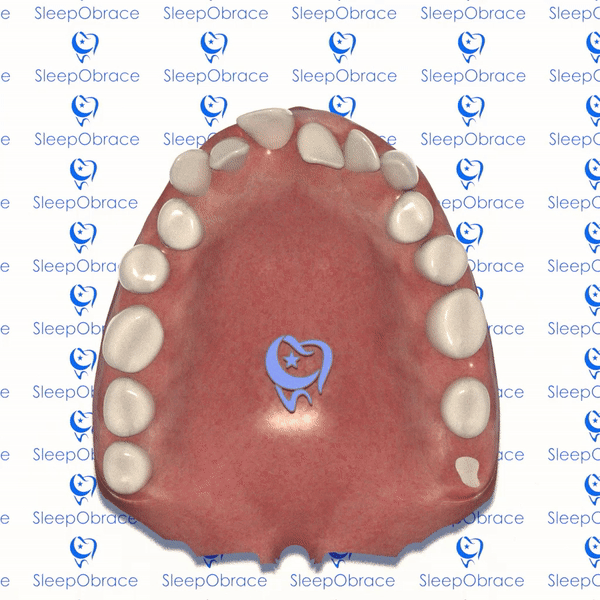 SleepObrace™ ADULTS